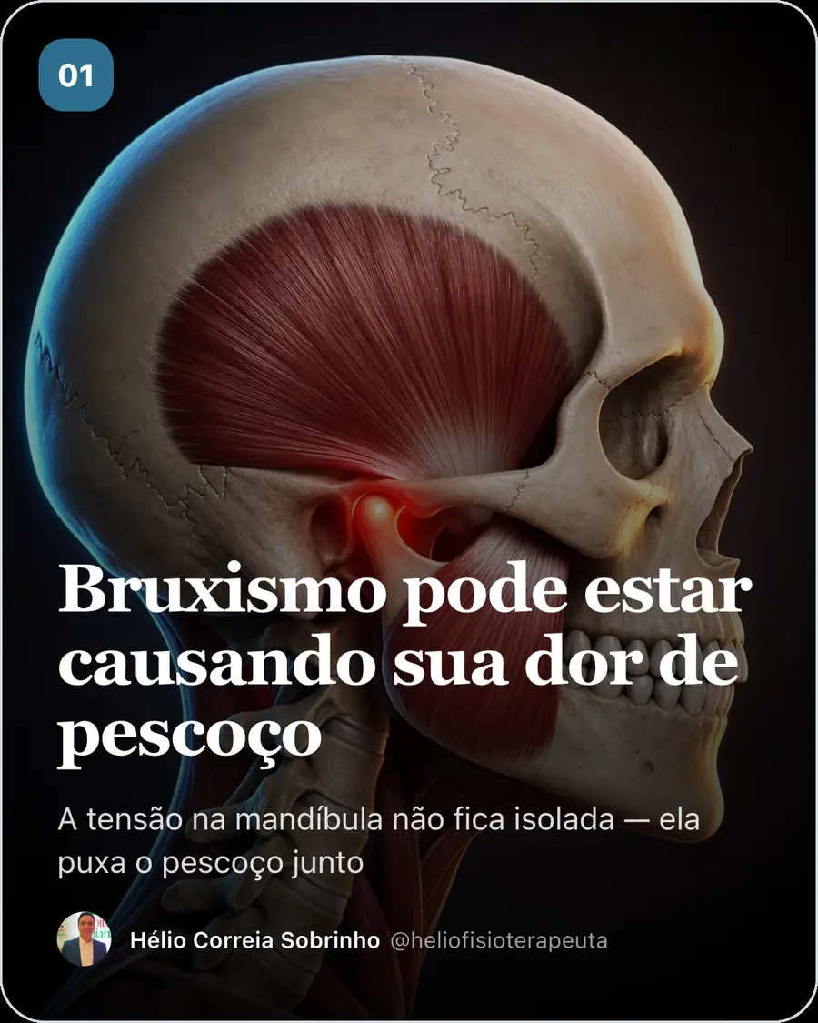 Bruxismo pode estar causando sua dor de pescoço. A tensão na mandíbula não fica isolada — ela puxa o pescoço junto