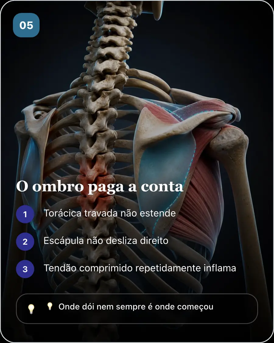 O ombro paga a conta. Torácica travada não estende. Escápula não desliza direito. Tendão comprimido repetidamente inflama