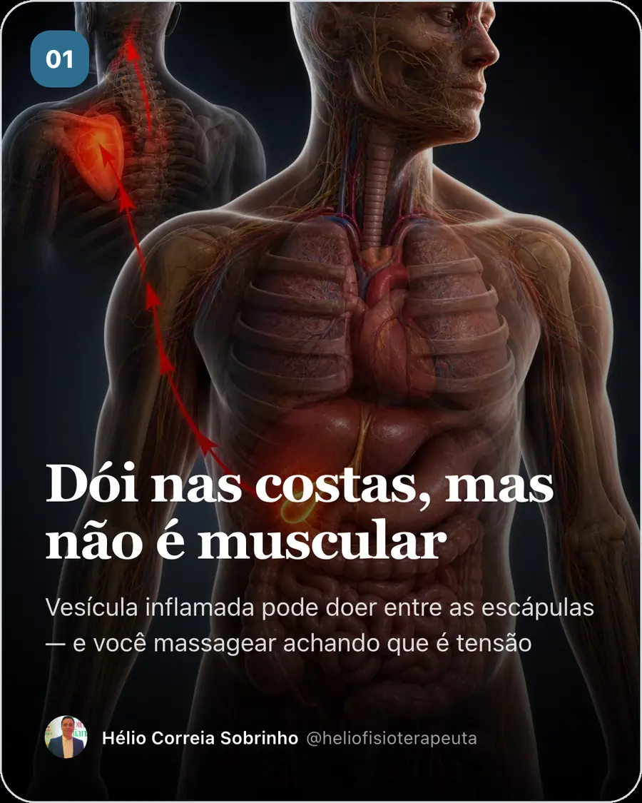 Dói nas costas, mas não é muscular. Vesícula inflamada pode doer entre as escápulas — e você massagear achando que é tensão