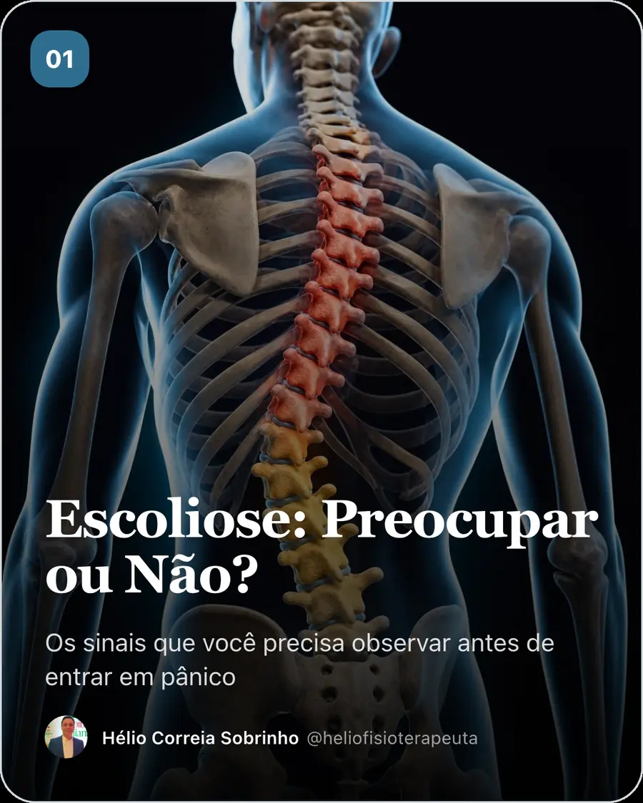 Escoliose: Preocupar ou Não?. Os sinais que você precisa observar antes de entrar em pânico