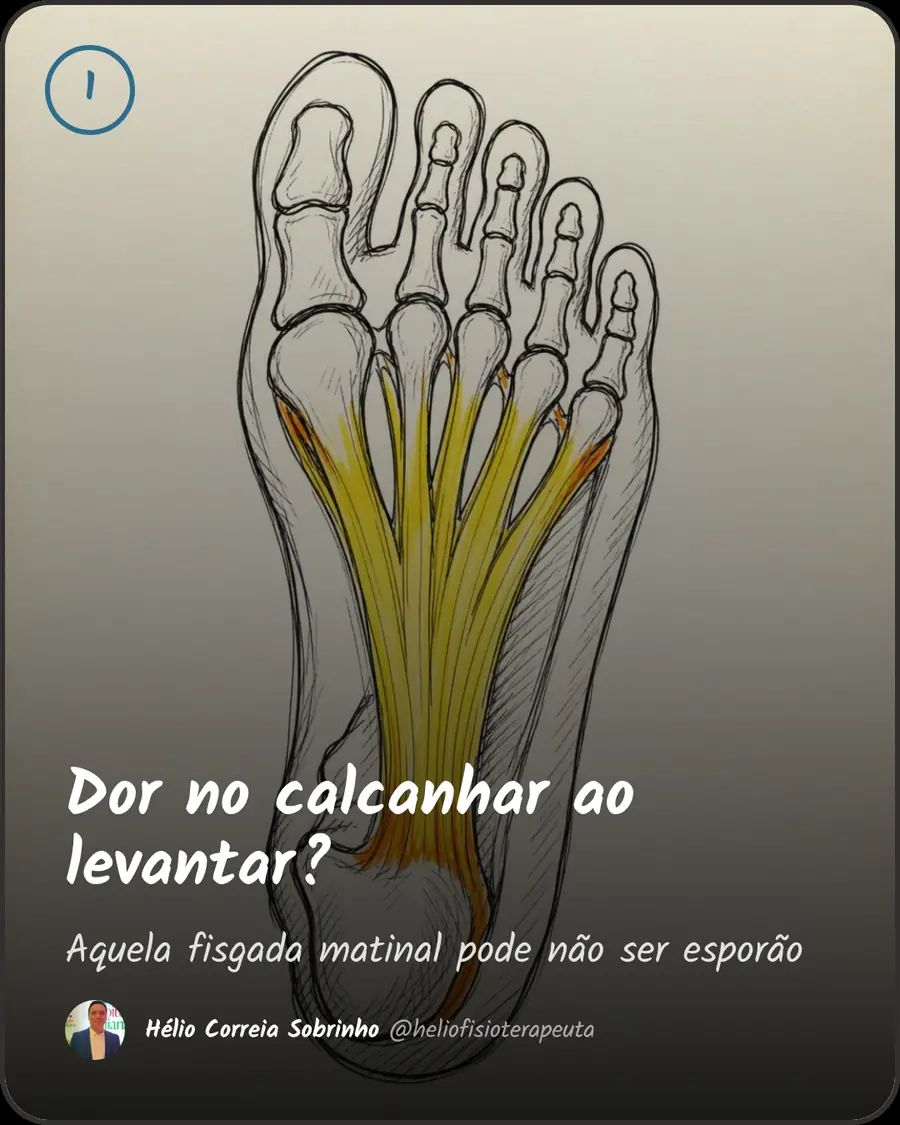 Dor no calcanhar ao levantar?. Aquela fisgada matinal pode não ser esporão