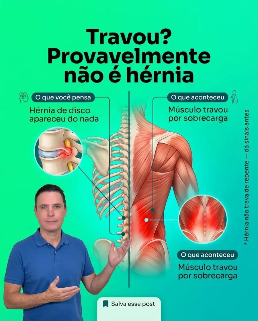 Post do Dr. Hélio no Instagram: Travou? Provavelmente não é hérnia